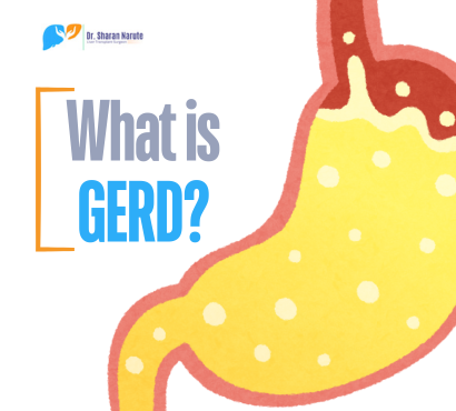 GERD-Post