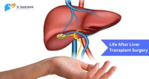 Discover essential precautions, lifestyle changes, and recovery tips after liver transplant surgery from an expert liver transplant surgeon in Pune