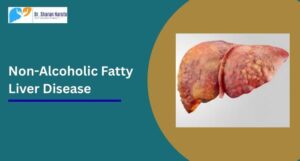 Learn about Non-Alcoholic Fatty Liver Disease, its causes, symptoms, and treatments. Get expert guidance from a leading Liver Transplant Surgeon in Pune for advanced liver care.