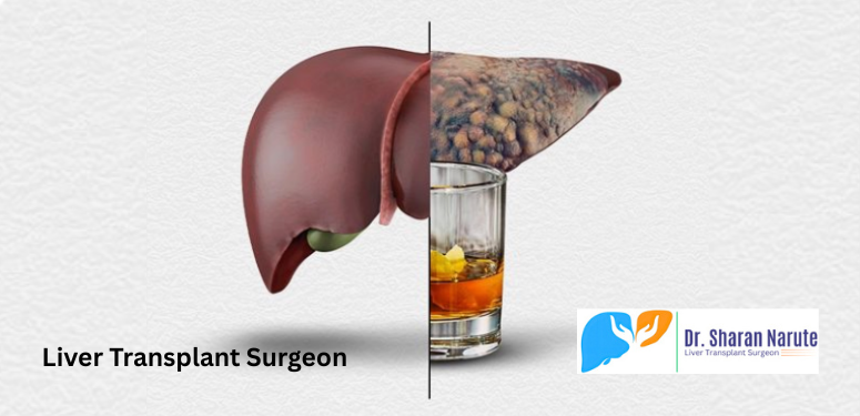 Liver Transplant Surgeon in Pune