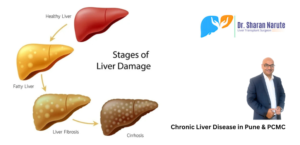 Chronic Liver Disease in Pune & PCMC - Dr. Sharan Narute
