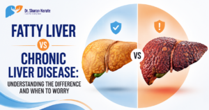 Featured blog image for "Fatty Liver vs Chronic Liver Disease: Understanding the Difference and When to Worry" featuring Dr. Sharan Narute's logo, a healthy and diseased liver illustration, and a clean medical-themed background highlighting liver health awareness.