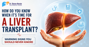 Medical awareness post titled "How Do You Know When It's Time for a Liver Transplant? Warning Signs You Should Never Ignore" featuring a liver illustration and Dr. Sharan Nature's official logo, promoting liver transplant awareness and timely specialist consultation.